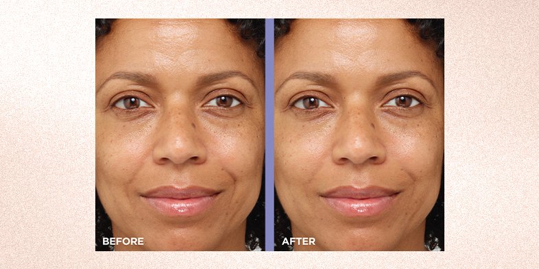 In-Article-primer-or-moisturizer-first_2